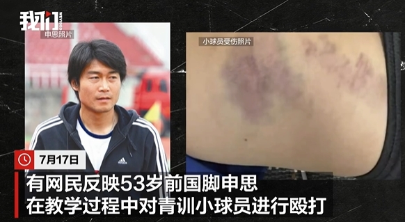 申思掌掴小球员事件:俱乐部称其顾问身份,家长已报警